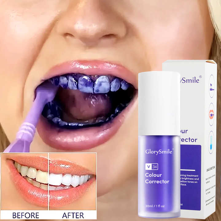 Blanqueamiento dental morado v34